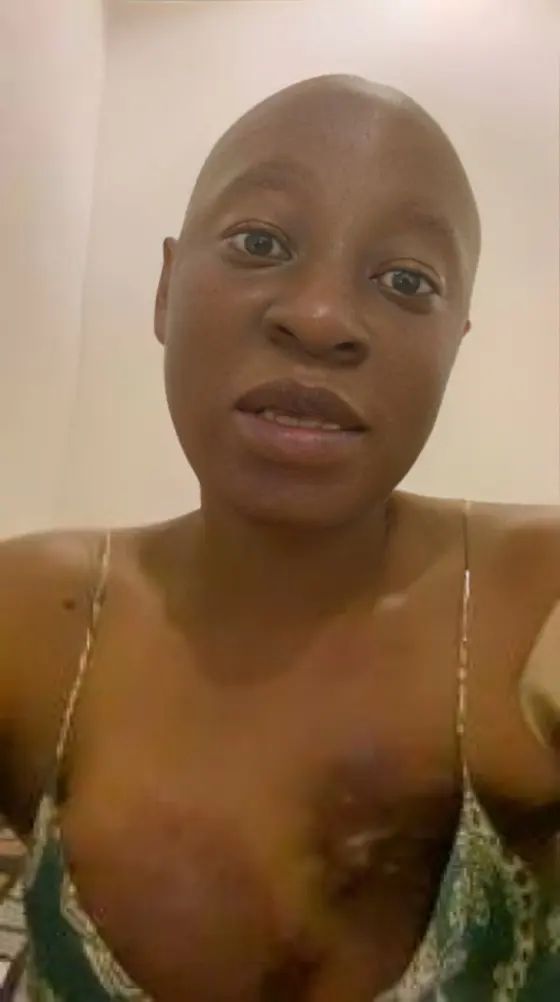 Nollywood Actress Cynthia Anijekwu Reveals Cancer Has Spread to Her Bones, Pleads for Help With ₦600k Monthly Bills 12 e03ce532 3a30 43b9 adca b2517f3261886436519121817382739